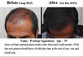 Click image for larger version

Name:	nigam-before-after-4.jpg
Views:	2949
Size:	28.1 KB
ID:	434999