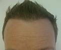 Click image for larger version

Name:	Hairline.jpg
Views:	410
Size:	46.3 KB
ID:	435046