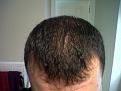 Click image for larger version

Name:	IMG01333-20130129-1409.jpg
Views:	5393
Size:	99.8 KB
ID:	435096