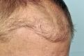 Click image for larger version

Name:	low_hairline.jpg
Views:	258
Size:	97.2 KB
ID:	435214