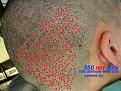Click image for larger version

Name:	whitedots-RED.jpg
Views:	3742
Size:	79.0 KB
ID:	435224
