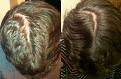 Click image for larger version

Name:	hair 1.jpg
Views:	411
Size:	20.1 KB
ID:	435334