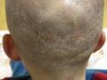 Click image for larger version

Name:	James-Bald-Donor-Area.jpg
Views:	947
Size:	56.6 KB
ID:	436266