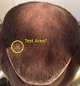 Click image for larger version

Name:	James-Bald-BEFORE.jpg
Views:	3086
Size:	68.8 KB
ID:	436303