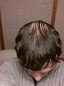 Click image for larger version

Name:	20130117_230733.jpg
Views:	425
Size:	92.8 KB
ID:	436330