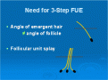 Click image for larger version

Name:	3step-fue-fig-1.gif
Views:	297
Size:	7.3 KB
ID:	436378
