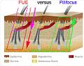 Click image for larger version

Name:	FUE-vs-Pilifocus.jpg
Views:	3827
Size:	33.5 KB
ID:	436450