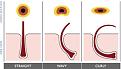 Click image for larger version

Name:	wavy-follicles.jpg
Views:	2089
Size:	10.9 KB
ID:	436453