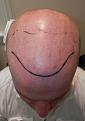 Click image for larger version

Name:	Plannedhairline.jpg
Views:	504
Size:	93.4 KB
ID:	436483