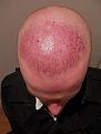 Click image for larger version

Name:	Afterimplant1.jpg
Views:	463
Size:	90.3 KB
ID:	436485