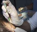 Click image for larger version

Name:	Injection-Treatment.jpg
Views:	1015
Size:	67.2 KB
ID:	436498