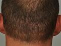 Click image for larger version

Name:	11 months with 2 guard cut.jpg
Views:	1006
Size:	96.5 KB
ID:	436573