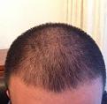 Click image for larger version

Name:	hairline2013.jpg
Views:	331
Size:	10.9 KB
ID:	436648
