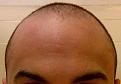 Click image for larger version

Name:	IMG-20130329-05266.jpg
Views:	337
Size:	65.6 KB
ID:	436664