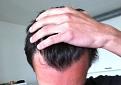 Click image for larger version

Name:	hairline 4 (2).jpg
Views:	3108
Size:	52.7 KB
ID:	436687