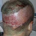 Click image for larger version

Name:	Artas Vs. 0.8mm punch.jpg
Views:	345
Size:	17.1 KB
ID:	436696