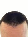 Click image for larger version

Name:	NewHair3.jpg
Views:	825
Size:	2.5 KB
ID:	436804