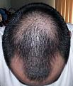 Click image for larger version

Name:	month 3 top.jpg
Views:	1351
Size:	46.0 KB
ID:	436850