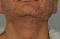 Click image for larger version

Name:	beard-extractions.jpg
Views:	964
Size:	76.2 KB
ID:	436912