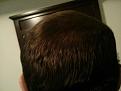 Click image for larger version

Name:	Day 21 - Back Dry.jpg
Views:	520
Size:	83.4 KB
ID:	436953
