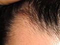 Click image for larger version

Name:	hairlineshots 015.jpg
Views:	413
Size:	89.0 KB
ID:	436979