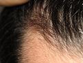 Click image for larger version

Name:	hairlineshots 005.jpg
Views:	457
Size:	88.3 KB
ID:	436980