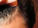 Click image for larger version

Name:	hairline222 020.jpg
Views:	348
Size:	89.0 KB
ID:	436993