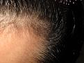 Click image for larger version

Name:	hairline222 022.jpg
Views:	346
Size:	90.7 KB
ID:	436994