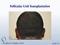 Click image for larger version

Name:	Slide09.jpg
Views:	393
Size:	64.1 KB
ID:	437093