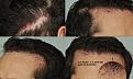 Click image for larger version

Name:	before_shaved.jpg
Views:	385
Size:	98.3 KB
ID:	437190