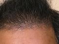 Click image for larger version

Name:	leg hair before.jpg
Views:	287
Size:	60.2 KB
ID:	437214