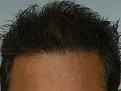 Click image for larger version

Name:	leg hair after.jpg
Views:	311
Size:	97.4 KB
ID:	437215