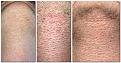 Click image for larger version

Name:	9 day beard comparison.jpg
Views:	1016
Size:	101.4 KB
ID:	437321