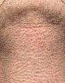 Click image for larger version

Name:	beard test 9 day post.jpg
Views:	647
Size:	95.4 KB
ID:	437323