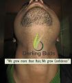 Click image for larger version

Name:	Post_op_beard_area.jpg
Views:	597
Size:	14.0 KB
ID:	437324