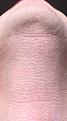 Click image for larger version

Name:	9 days post shaven.jpg
Views:	744
Size:	95.8 KB
ID:	437325
