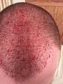 Click image for larger version

Name:	bleed1.jpg
Views:	960
Size:	90.0 KB
ID:	437329