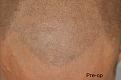 Click image for larger version

Name:	pre-op-smp.jpg
Views:	1164
Size:	86.8 KB
ID:	437337
