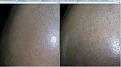 Click image for larger version

Name:	6 Month left temple.jpg
Views:	2112
Size:	92.3 KB
ID:	437360