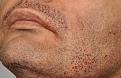 Click image for larger version

Name:	extractions-beard-moustache-12-11-13.jpg
Views:	382
Size:	97.1 KB
ID:	437363