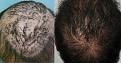 Click image for larger version

Name:	back-top of head-side-by-side.jpg
Views:	322
Size:	67.9 KB
ID:	437378