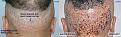 Click image for larger version

Name:	side-by-side-scar.jpg
Views:	403
Size:	110.6 KB
ID:	437379
