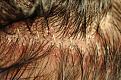 Click image for larger version

Name:	JN_Suture Line At Removal.jpg
Views:	484
Size:	101.2 KB
ID:	437384