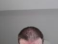 Click image for larger version

Name:	20131221_145626.jpg
Views:	817
Size:	61.9 KB
ID:	437454