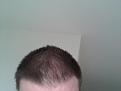 Click image for larger version

Name:	20131221_151030.jpg
Views:	747
Size:	50.8 KB
ID:	437458