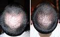Click image for larger version

Name:	comparison crown 1-9-14.JPG
Views:	2066
Size:	27.9 KB
ID:	437467