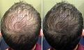 Click image for larger version

Name:	side-by-side-flash.jpg
Views:	313
Size:	99.4 KB
ID:	438296