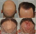 Click image for larger version

Name:	Update-3-12-14.jpg
Views:	616
Size:	95.7 KB
ID:	438307