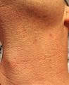 Click image for larger version

Name:	lt neck post shave 45 days..jpg
Views:	426
Size:	87.9 KB
ID:	438322