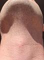 Click image for larger version

Name:	straight view 45 days post.jpg
Views:	461
Size:	94.6 KB
ID:	438323
